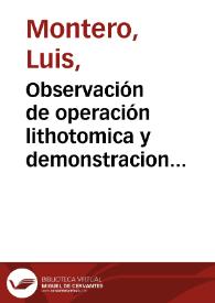 Portada:Observación de operación lithotomica y demonstracion anatomica operada, y demonstrada en el insigne hospital del el espiritu santo de calle colcheros / por don Luis Montero ...